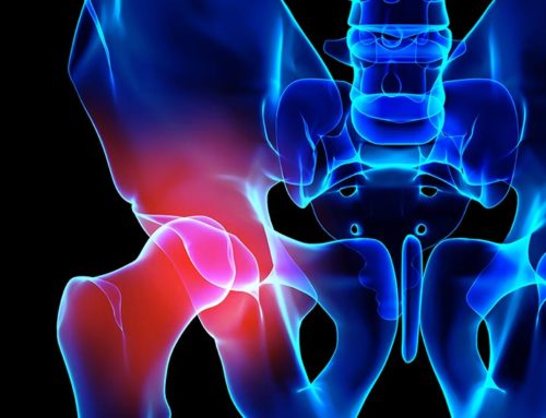 Acupuncture Can Treat Hip Pain
